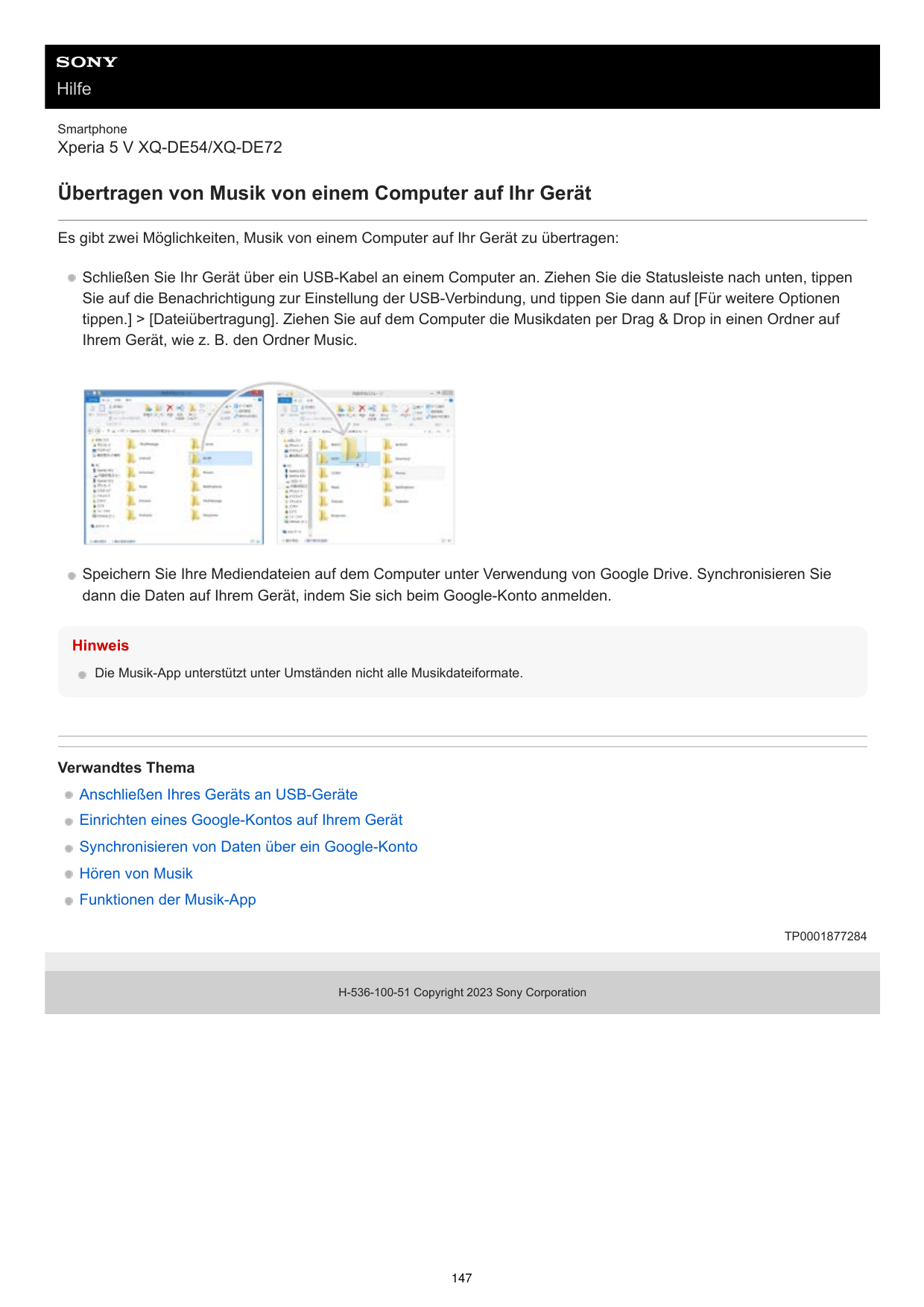 HilfeSmartphoneXperia 5 V XQ-DE54/XQ-DE72Übertragen von Musik von einem Computer auf Ihr GerätEs gibt zwei Möglichkeiten, Musik 